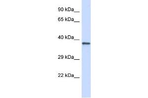 Host: Rabbit Target Name: GP1BA Sample Type: Jurkat Whole Cell lysates Antibody Dilution: 1. (CD42b anticorps  (Middle Region))