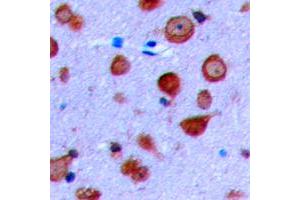 Immunohistochemical analysis of Kir6.