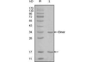 Western blot analysis using EP300 mouse mAb against truncated EP300-His recombinant protein (1).