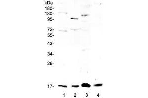 Western blot testing of 1) rat brain, 2) rat lung, 3) rat RH35 and 4) mouse lung lysate with Il1f10 antibody at 0. (IL1F10 anticorps)
