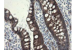 Image no. 8 for anti-Src-like-adaptor 2 (SLA2) antibody (ABIN1500949) (SLAP2 anticorps)