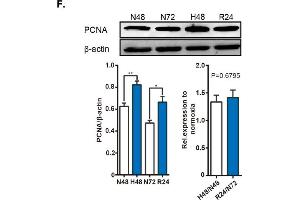NgBR expression is downregulated in the pulmonary artery of HPH rat model and in vascular smooth muscle cells (VSMCs) exposed to hypoxia.