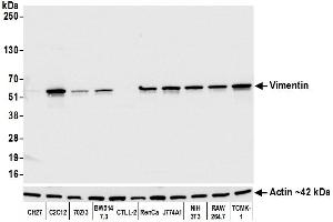 Western Blotting (WB) image for anti-Vimentin (VIM) (AA 325-375) antibody (ABIN7449539)
