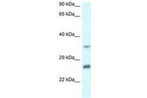 Image no. 1 for anti-Carbonyl Reductase 4 (CBR4) (AA 156-205) antibody (ABIN6747447) (CBR4 anticorps  (AA 156-205))