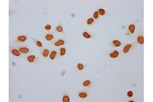 Immunocytochemistry analysis of ABIN7139193 diluted at 1:50 and staining in Hela cells (treated with 30mM sodium butyrate for 4h) performed on a Leica BondTM system.