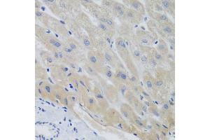 Immunohistochemistry of paraffin-embedded human liver using PTTG1 antibody (ABIN5974823) at dilution of 1/100 (40x lens). (PTTG1 anticorps)