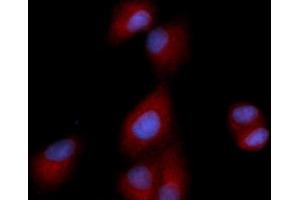 Immunofluorescence (IF) image for anti-Dipeptidyl-Peptidase 4 (DPP4) (AA 39-766) antibody (PE) (ABIN5566986) (DPP4 anticorps  (AA 39-766) (PE))