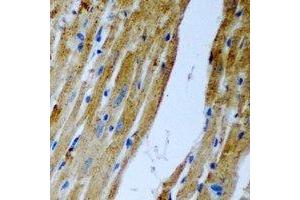 Immunohistochemical analysis of Malcavernin staining in rat heart formalin fixed paraffin embedded tissue section. (CCM2 anticorps)
