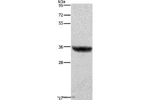 Western blot analysis of Human placenta tissue , using HSD17B1 Polyclonal Antibody at dilution of 1:700 (HSD17B1 anticorps)