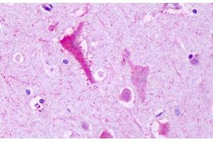 Anti-GPR137B antibody IHC staining of brain, neurons. (GPR137B anticorps  (C-Term))