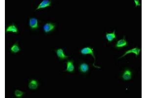 Immunofluorescence staining of A549 cells with ABIN7151029 at 1:33, counter-stained with DAPI.