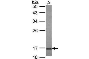 WB Image Sample (30 ug of whole cell lysate) A: Hela 10% SDS PAGE antibody diluted at 1:1000 (UBE2A anticorps)