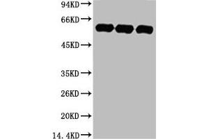 Western blot analysis of 1) Hela, 2) Rat BrianTissue, 3) Mouse Brain Tissue, diluted at 1:5000. (TUBA1A anticorps)