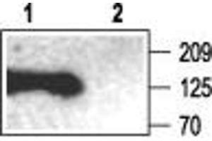 Discs, Large Homolog 3 (DLG3) peptide