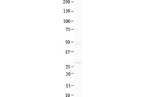 Host:  Rabbit  Target Name:  BMP7  Sample Type:  Human Thyroid  Antibody Dilution:  1.