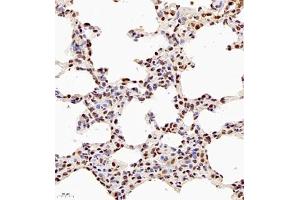 Immunohistochemistry of paraffin embedded rat lung using NSFL1C (ABIN7074865) at dilution of 1:700 (400x lens)