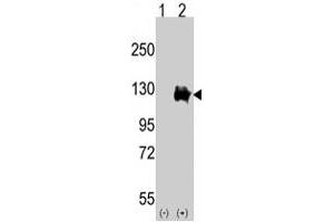 Western blot analysis of TRPM8 (arrow) using rabbit TRPM8 polyclonal antibody . (TRPM8 anticorps  (AA 1075-1104))
