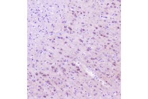 IHC analysis of RASAL1 using anti-RASAL1 antibody (ABIN6719367). (RASAL1 anticorps  (AA 721-798))