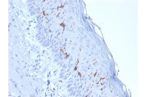 Formalin-fixed, paraffin-embedded human Skin stained with CD1a Mouse Recombinant Monoclonal Antibody (rC1A/711).