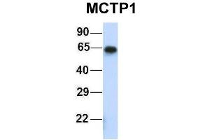 Host:  Rabbit  Target Name:  MCTP1  Sample Type:  Human Fetal Muscle  Antibody Dilution:  1. (MCTP1 anticorps  (Middle Region))