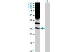 Western Blot analysis of PSMD10 expression in transfected 293T cell line by PSMD10 MaxPab rabbit polyclonal antibody. (PSMD10 anticorps  (AA 1-226))