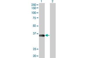 Western Blot analysis of MSI2 expression in transfected 293T cell line by MSI2 monoclonal antibody (M09), clone 3C6. (MSI2 anticorps  (AA 1-328))