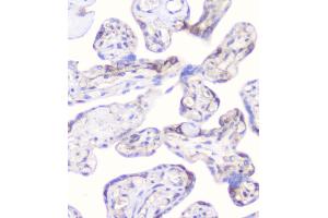 IHC analysis of CD2AP using anti-CD2AP antibody (ABIN6719544). (CD2AP anticorps  (AA 253-337))