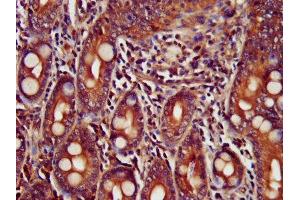 IHC image of ABIN7173439 diluted at 1:400 and staining in paraffin-embedded human small intestine tissue performed on a Leica BondTM system.