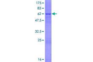 Image no. 1 for Fructosamine 3 Kinase (FN3K) (AA 1-309) protein (GST tag) (ABIN1354264)