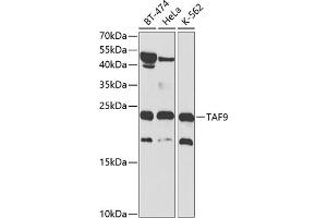 Western blot analysis of extracts of various cell lines, using T antibody (ABIN3015850, ABIN3015851, ABIN1682962 and ABIN6219191) at 1:1000 dilution. (TAF9 anticorps  (AA 1-172))