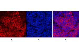 Immunofluorescence analysis of rat spleen tissue. (PARP1 anticorps  (Cleaved-Asp214))