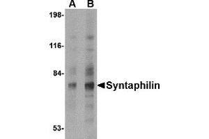 Western Blotting (WB) image for anti-Syntaphilin (SNPH) (N-Term) antibody (ABIN1031595) (Syntaphilin anticorps  (N-Term))
