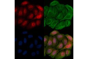 ABIN6256500 and ABIN6267669 staining Hela cells(20 min of 30uM Forskolin treatment) by IF/ICC. (CAMK4 anticorps  (pThr200))
