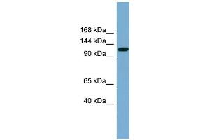 WB Suggested Anti-SLC12A5 Antibody Titration:  0. (KCC2 anticorps  (Middle Region))