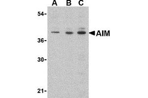 Western Blotting (WB) image for anti-AIM (C-Term) antibody (ABIN1030228) (AIM (C-Term) anticorps)