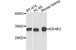 Western blot analysis of extracts of various cell lines, using EIF4E2 antibody. (EIF4E2 anticorps)