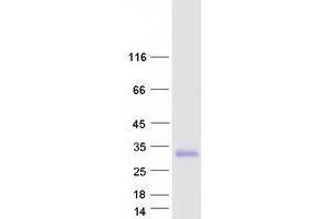 Validation with Western Blot