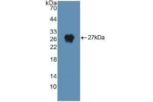 Detection of Recombinant DNM2, Human using Polyclonal Antibody to Dynamin 2 (DNM2) (DNM2 anticorps  (AA 533-731))