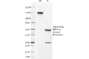 SDS-PAGE Analysis Purified Androgen Receptor Mouse Monoclonal Antibody (AR441). (Androgen Receptor anticorps  (AA 302-318))