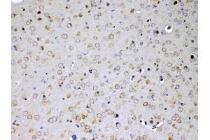 anti-Interleukin 15 Receptor, alpha (IL15RA) (AA 31-174) antibody