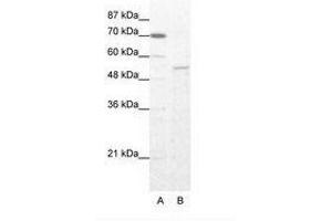 Image no. 1 for anti-Zinc Finger Protein 665 (ZNF665) (AA 146-195) antibody (ABIN202996) (ZNF665 anticorps  (AA 146-195))