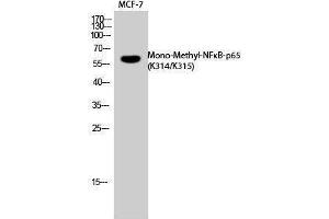 Western Blotting (WB) image for anti-Nuclear Factor-kB p65 (NFkBP65) (acLys314), (acLys315) antibody (ABIN3181858) (NF-kB p65 anticorps  (acLys314, acLys315))