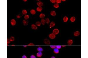 Immunofluorescence analysis of HeLa cells using CYP11B2 Polyclonal Antibody at dilution of 1:100 (40x lens).