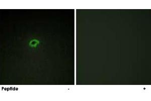 Immunofluorescence analysis of COS-7 cells, using COL4A4 polyclonal antibody . (Col4a4 anticorps)