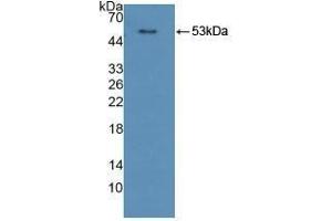 Detection of Recombinant CPR, Human using Polyclonal Antibody to Cytochrome P450 Reductase (CPR) (POR anticorps  (AA 77-518))