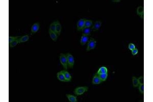 Immunofluorescent analysis of HepG2 cells using ABIN7146099 at dilution of 1:100 and Alexa Fluor 488-congugated AffiniPure Goat Anti-Rabbit IgG(H+L)