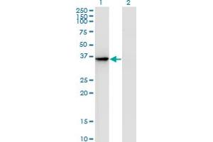 Western Blot analysis of AKR1D1 expression in transfected 293T cell line by AKR1D1 monoclonal antibody (M01), clone 1A6. (AKR1D1 anticorps  (AA 227-326))