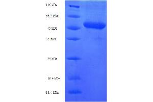 SDS-PAGE (SDS) image for Neuregulin 2 (NRG2) (AA 112-405) protein (His-SUMO Tag) (ABIN5710027)