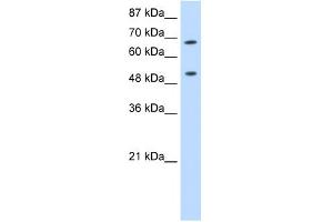 WB Suggested Anti-THOC1 Antibody Titration:  0. (THOC1 anticorps  (C-Term))