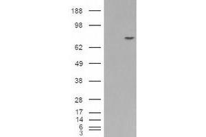 Image no. 2 for anti-Premelanosome Protein (PMEL) (C-Term) antibody (ABIN374704) (Melanoma gp100 anticorps  (C-Term))